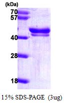 DFFA / ICAD / DFF45 Protein