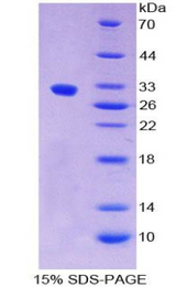DFFA / ICAD / DFF45 Protein - Recombinant DNA Fragmentation Factor Subunit Alpha By SDS-PAGE