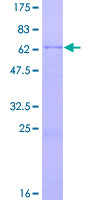 DFFB Protein - 12.5% SDS-PAGE of human DFFB stained with Coomassie Blue