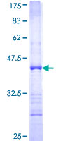 DFFB Protein - 12.5% SDS-PAGE Stained with Coomassie Blue.