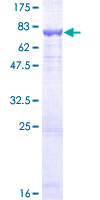 DFNA5 Protein - 12.5% SDS-PAGE of human DFNA5 stained with Coomassie Blue