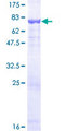 DFNA5 Protein - 12.5% SDS-PAGE of human DFNA5 stained with Coomassie Blue