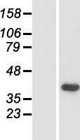 DFNB59 / PJVK Protein - Western validation with an anti-DDK antibody * L: Control HEK293 lysate R: Over-expression lysate