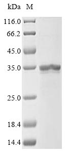 DGAT1 Protein - (Tris-Glycine gel) Discontinuous SDS-PAGE (reduced) with 5% enrichment gel and 15% separation gel.
