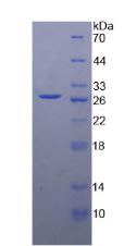 DGAT1 Protein - Recombinant Diacylglycerol-O-Acyltransferase Homolog 1 By SDS-PAGE