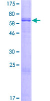 DGAT2 Protein - 12.5% SDS-PAGE of human DGAT2 stained with Coomassie Blue