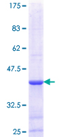DGAT2 Protein - 12.5% SDS-PAGE Stained with Coomassie Blue.