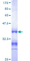 DGCR14 Protein - 12.5% SDS-PAGE Stained with Coomassie Blue.