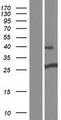 DGCR6 Protein - Western validation with an anti-DDK antibody * L: Control HEK293 lysate R: Over-expression lysate