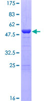DGCR6 Protein - 12.5% SDS-PAGE of human DGCR6 stained with Coomassie Blue