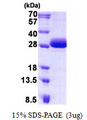 DGCR6 Protein