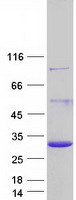 DGCR6 Protein - Purified recombinant protein DGCR6 was analyzed by SDS-PAGE gel and Coomassie Blue Staining