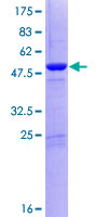 DGCR6L Protein - 12.5% SDS-PAGE of human DGCR6L stained with Coomassie Blue