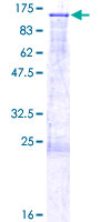 DGCR8 Protein - 12.5% SDS-PAGE of human DGCR8 stained with Coomassie Blue