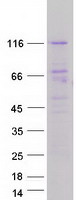 DGK-IOTA / DGKI Protein - Purified recombinant protein DGKI was analyzed by SDS-PAGE gel and Coomassie Blue Staining