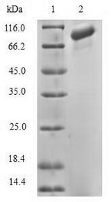 DGKA Protein - (Tris-Glycine gel) Discontinuous SDS-PAGE (reduced) with 5% enrichment gel and 15% separation gel.