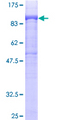 DGKA Protein - 12.5% SDS-PAGE of human DGKA stained with Coomassie Blue