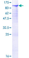 DGKA Protein - 12.5% SDS-PAGE of human DGKA stained with Coomassie Blue