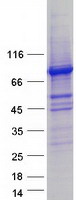 DGKA Protein - Purified recombinant protein DGKA was analyzed by SDS-PAGE gel and Coomassie Blue Staining