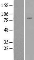 DGKB / DGK Beta Protein - Western validation with an anti-DDK antibody * L: Control HEK293 lysate R: Over-expression lysate
