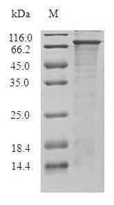 DGKE / DGK Epsilon Protein - (Tris-Glycine gel) Discontinuous SDS-PAGE (reduced) with 5% enrichment gel and 15% separation gel.