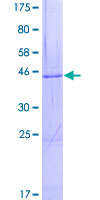 DGKE / DGK Epsilon Protein - 12.5% SDS-PAGE of human DGKE stained with Coomassie Blue