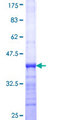 DGKE / DGK Epsilon Protein - 12.5% SDS-PAGE Stained with Coomassie Blue.