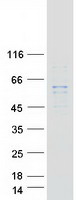 DGKE / DGK Epsilon Protein - Purified recombinant protein DGKE was analyzed by SDS-PAGE gel and Coomassie Blue Staining