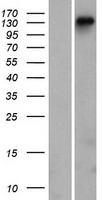 DGKeta / DGKH Protein - Western validation with an anti-DDK antibody * L: Control HEK293 lysate R: Over-expression lysate