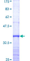DGKeta / DGKH Protein - 12.5% SDS-PAGE Stained with Coomassie Blue.