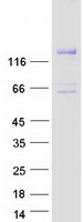 DGKeta / DGKH Protein - Purified recombinant protein DGKH was analyzed by SDS-PAGE gel and Coomassie Blue Staining