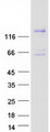 DGKeta / DGKH Protein - Purified recombinant protein DGKH was analyzed by SDS-PAGE gel and Coomassie Blue Staining
