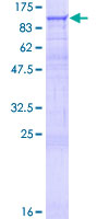 DGKG Protein - 12.5% SDS-PAGE of human DGKG stained with Coomassie Blue