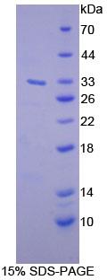 DGKG Protein - Recombinant Diacylglycerol Kinase Gamma By SDS-PAGE