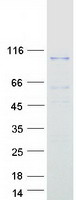 DGKG Protein - Purified recombinant protein DGKG was analyzed by SDS-PAGE gel and Coomassie Blue Staining
