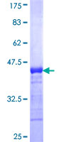DGKK Protein - 12.5% SDS-PAGE Stained with Coomassie Blue.