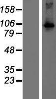 DGKQ Protein - Western validation with an anti-DDK antibody * L: Control HEK293 lysate R: Over-expression lysate