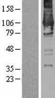 DGKZ Protein - Western validation with an anti-DDK antibody * L: Control HEK293 lysate R: Over-expression lysate