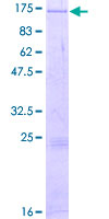 DGKZ Protein - 12.5% SDS-PAGE of human DGKZ stained with Coomassie Blue