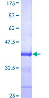 DGKZ Protein - 12.5% SDS-PAGE Stained with Coomassie Blue.