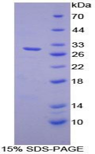 DGKZ Protein - Recombinant Diacylglycerol Kinase Zeta By SDS-PAGE