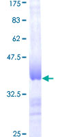 DGUOK / Deoxyguanosine Kinase Protein - 12.5% SDS-PAGE Stained with Coomassie Blue.