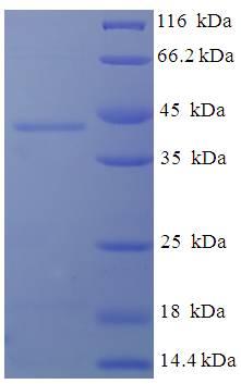 DGUOK / Deoxyguanosine Kinase Protein