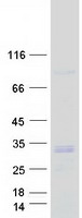DGUOK / Deoxyguanosine Kinase Protein - Purified recombinant protein DGUOK was analyzed by SDS-PAGE gel and Coomassie Blue Staining