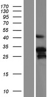 DHAND / HAND2 Protein - Western validation with an anti-DDK antibody * L: Control HEK293 lysate R: Over-expression lysate