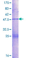DHAND / HAND2 Protein - 12.5% SDS-PAGE of human HAND2 stained with Coomassie Blue