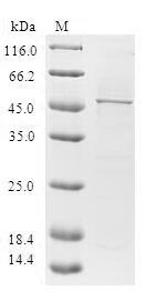 DHAND / HAND2 Protein - (Tris-Glycine gel) Discontinuous SDS-PAGE (reduced) with 5% enrichment gel and 15% separation gel.