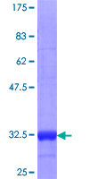 DHAND / HAND2 Protein - 12.5% SDS-PAGE Stained with Coomassie Blue.