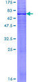 DHCR7 Protein - 12.5% SDS-PAGE of human DHCR7 stained with Coomassie Blue