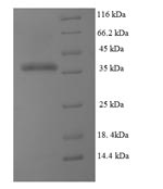 DHFR Protein - (Tris-Glycine gel) Discontinuous SDS-PAGE (reduced) with 5% enrichment gel and 15% separation gel.